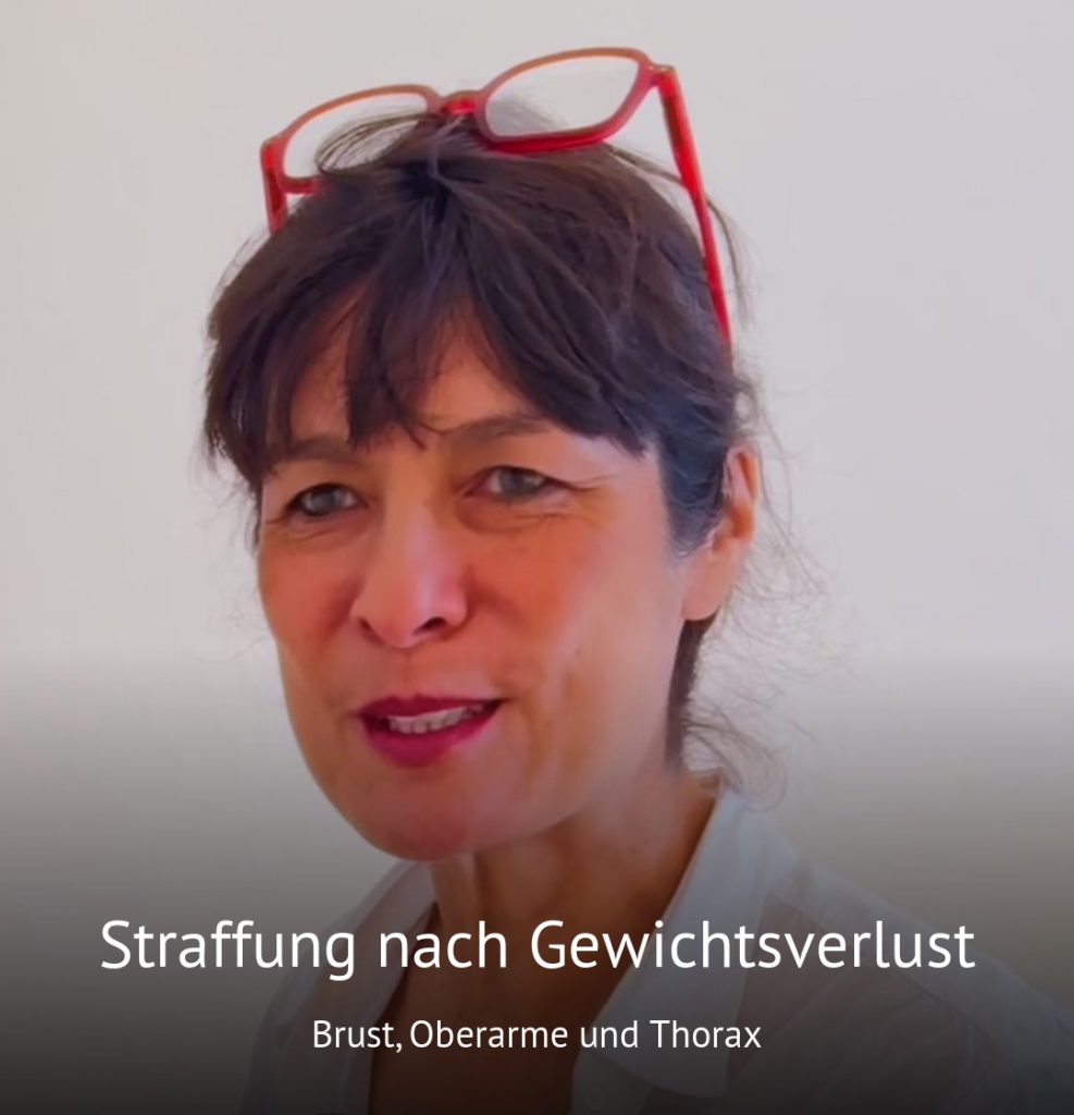 Dr. med. Zeynep Potente erklärt die Straffung von Brust, Oberarmen und Thorax nach Gewichtsverlust